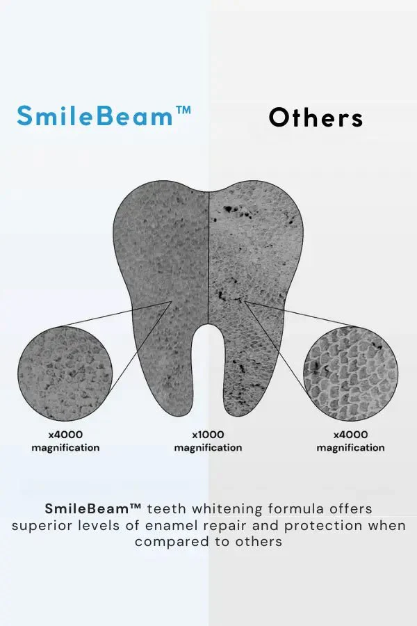 SmileBeam™ Wireless Teeth Whitening Kit - Image 2