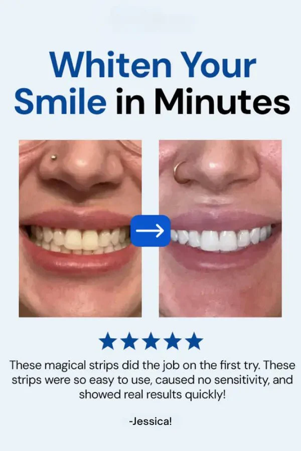 SmileBeam™ Wireless Teeth Whitening Kit - Image 3